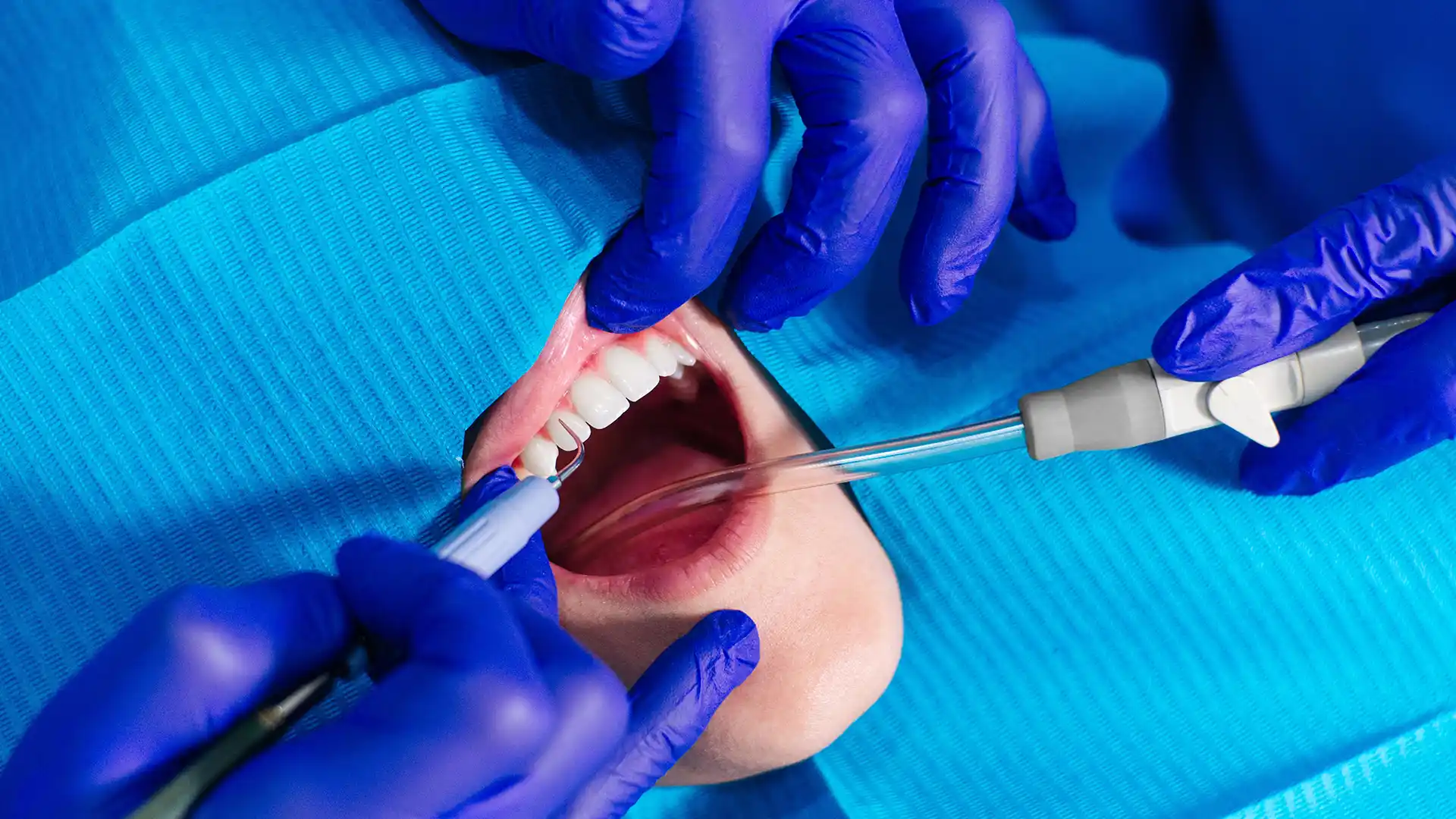 costa un sinus lift in Turchia